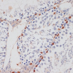 HTATSF1 Polyclonal Antibody, Invitrogen 100 &mu;L | Buy Online | Invitrogen | Fisher Scientific