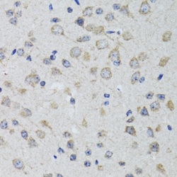 Invitrogen HTR3A Polyclonal Antibody 100 &mu;L | Buy Online | Invitrogen&trade; | Fisher Scientific