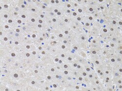 Invitrogen HUS1 Polyclonal Antibody 100 μL; Unconjugated:Antibodies,