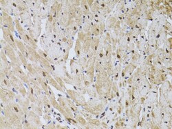 Invitrogen HUS1 Polyclonal Antibody 100 μL; Unconjugated:Antibodies,