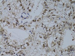 Invitrogen HUS1 Polyclonal Antibody 100 μL; Unconjugated:Antibodies,