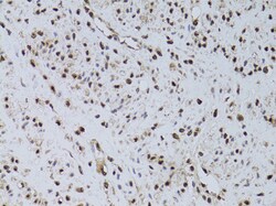 Invitrogen HUS1 Polyclonal Antibody 100 μL; Unconjugated:Antibodies,