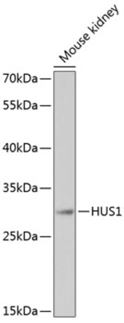 Invitrogen HUS1 Polyclonal Antibody 100 μL; Unconjugated:Antibodies,