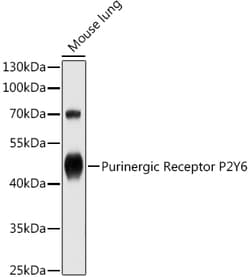 Invitrogen P2Y6 Polyclonal Antibody 100 &mu;L; Unconjugated:Antibodies,