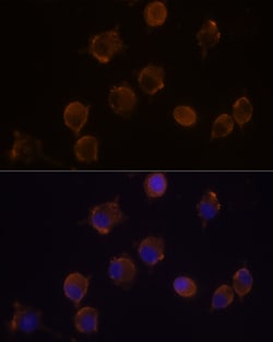 Invitrogen IL10RA Polyclonal Antibody 100 &mu;L; Unconjugated:Antibodies,