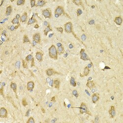 Invitrogen IL10RA Polyclonal Antibody 100 &mu;L; Unconjugated:Antibodies,