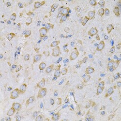 Invitrogen IL10RA Polyclonal Antibody 100 &mu;L; Unconjugated:Antibodies,