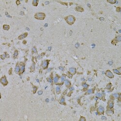 Invitrogen IL10RA Polyclonal Antibody 100 &mu;L; Unconjugated:Antibodies,