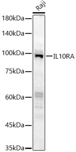 Invitrogen IL10RA Polyclonal Antibody 100 &mu;L; Unconjugated:Antibodies,