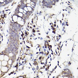 Invitrogen IL6R Polyclonal Antibody 100 &mu;L; Unconjugated:Antibodies,