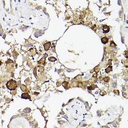 Invitrogen IL6R Polyclonal Antibody 100 &mu;L; Unconjugated:Antibodies,