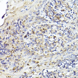 Invitrogen IL6R Polyclonal Antibody 100 &mu;L; Unconjugated:Antibodies,
