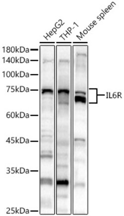 Invitrogen IL6R Polyclonal Antibody 100 &mu;L; Unconjugated:Antibodies,