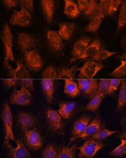 Invitrogen INPP5E Polyclonal Antibody 100 &mu;L; Unconjugated:Antibodies,
