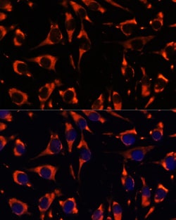 Invitrogen INPP5E Polyclonal Antibody 100 &mu;L; Unconjugated:Antibodies,