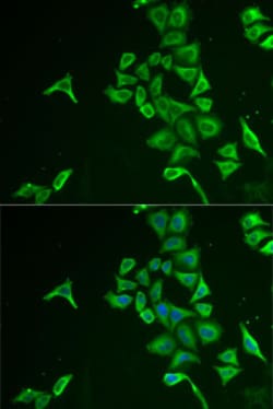Invitrogen INPP5J Polyclonal Antibody 100 &mu;L; Unconjugated:Antibodies,
