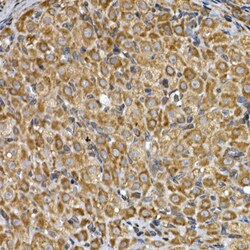 Invitrogen INSIG2 Polyclonal Antibody 100 &mu;L; Unconjugated:Antibodies,