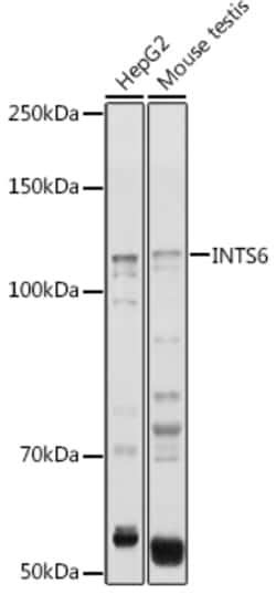 Invitrogen INTS6 Polyclonal Antibody 100 &mu;L | Buy Online | Invitrogen&trade; | Fisher Scientific