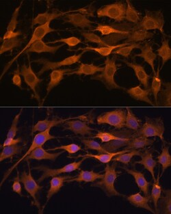 Invitrogen JAK1 Polyclonal Antibody 100 μL; Unconjugated:Antibodies,