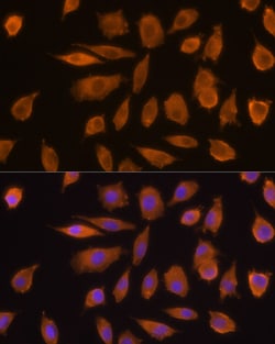 Invitrogen JAK1 Polyclonal Antibody 100 μL; Unconjugated:Antibodies,