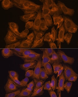 Invitrogen JAK1 Polyclonal Antibody 100 μL; Unconjugated:Antibodies,