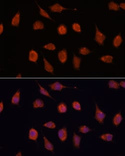 Invitrogen KCNAB2 Polyclonal Antibody 100 &mu;L; Unconjugated:Antibodies,
