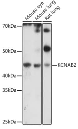 Invitrogen KCNAB2 Polyclonal Antibody 100 &mu;L; Unconjugated:Antibodies,