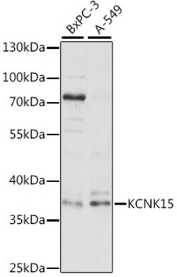 Invitrogen KCNK15 Polyclonal Antibody 100 &mu;L; Unconjugated:Antibodies,