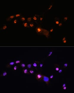 KLF8 Polyclonal Antibody:Antibodies, Polyclonal