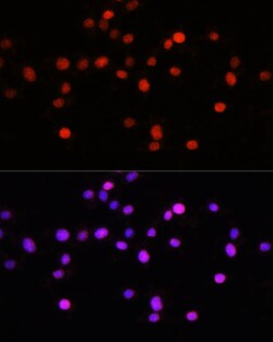 KLF8 Polyclonal Antibody:Antibodies, Polyclonal