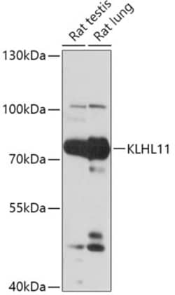 Invitrogen KLHL11 Polyclonal Antibody 100 μL; Unconjugated:Antibodies,