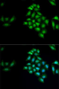 Invitrogen KLK4 Polyclonal Antibody 100 &mu;L; Unconjugated:Antibodies,