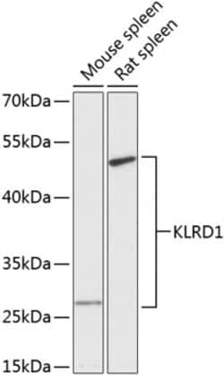 Invitrogen CD94 Polyclonal Antibody 100 &mu;L | Buy Online | Invitrogen&trade; | Fisher Scientific