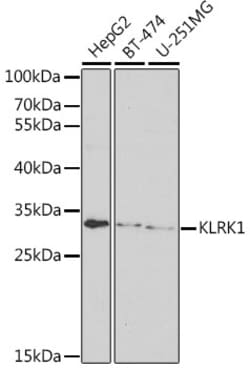 Invitrogen NKG2D Polyclonal Antibody 100 &mu;L | Buy Online | Invitrogen&trade; | Fisher Scientific