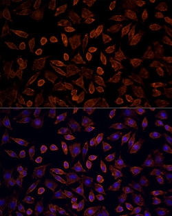 Invitrogen K-Ras Polyclonal Antibody 100 &mu;L; Unconjugated:Antibodies,