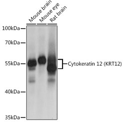 Invitrogen KRT12 Polyclonal Antibody 100 &mu;L; Unconjugated:Antibodies,