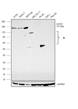Invitrogen LAMC2 Polyclonal Antibody 100 μL; Unconjugated:Antibodies,