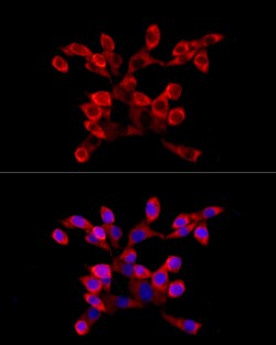 Invitrogen LARP4 Polyclonal Antibody 100 &mu;L; Unconjugated:Antibodies,
