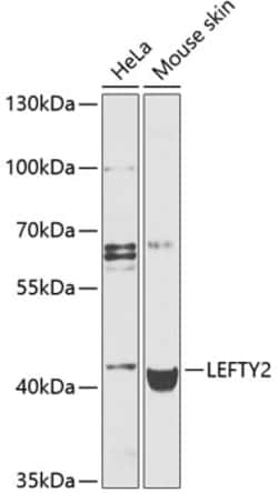 Invitrogen LEFTY2 Polyclonal Antibody 100 μL; Unconjugated:Antibodies,