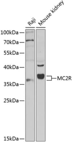 Invitrogen MC2R Polyclonal Antibody 100 &mu;L; Unconjugated:Antibodies,
