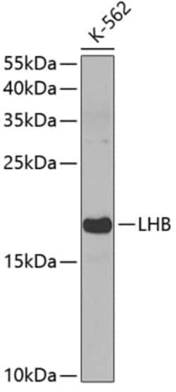Invitrogen Luteinizing Hormone-beta Polyclonal Antibody 100 &mu;L; Unconjugated:Antibodies,