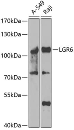 Invitrogen LGR6 Polyclonal Antibody 100 &mu;L | Buy Online | Invitrogen&trade; | Fisher Scientific
