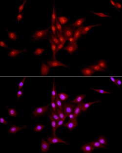 Invitrogen LIG3 Polyclonal Antibody 100 μL; Unconjugated:Antibodies,
