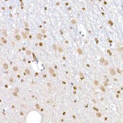 Invitrogen LIG3 Polyclonal Antibody 100 μL; Unconjugated:Antibodies,