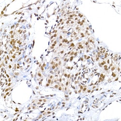 Invitrogen LIG3 Polyclonal Antibody 100 μL; Unconjugated:Antibodies,