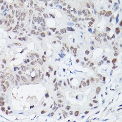 Invitrogen LIG4 Polyclonal Antibody 100 μL; Unconjugated:Antibodies,