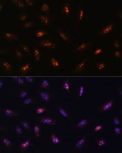 Invitrogen LLPH Polyclonal Antibody 100 &mu;L; Unconjugated:Antibodies,