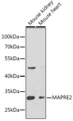 Invitrogen MAPRE2 Polyclonal Antibody 100 &mu;L; Unconjugated:Antibodies,