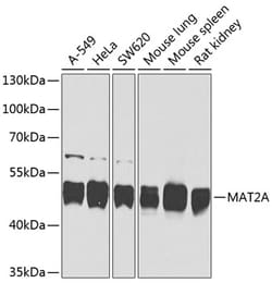 Invitrogen MAT2A Polyclonal Antibody 100 μL; Unconjugated:Antibodies,