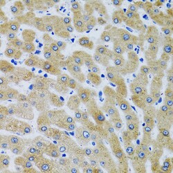 Invitrogen MBL2 Polyclonal Antibody 100 μL; Unconjugated:Antibodies,